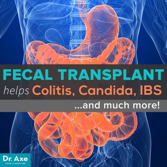 Fecal-Transplant-Title-Header.jpg