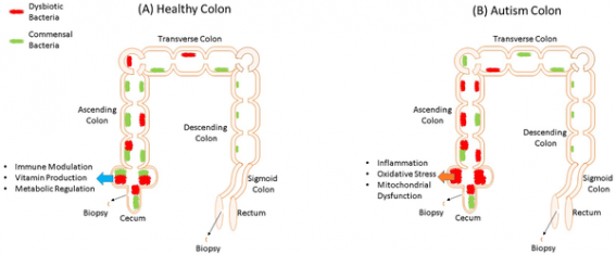 autism colon.png