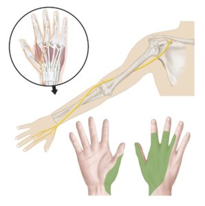 radialis.jpg
